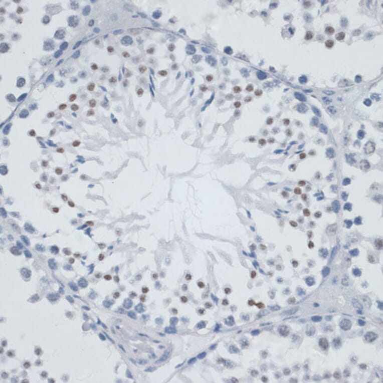 Immunohistochemistry - Anti-MSH6 Antibody (A91837) - Antibodies.com