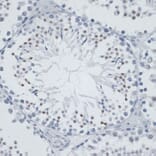 Immunohistochemistry - Anti-MSH6 Antibody (A91837) - Antibodies.com