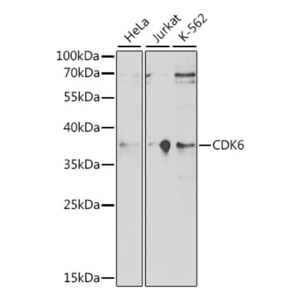 Western Blot - Anti-Cdk6 Antibody (A91841) - Antibodies.com