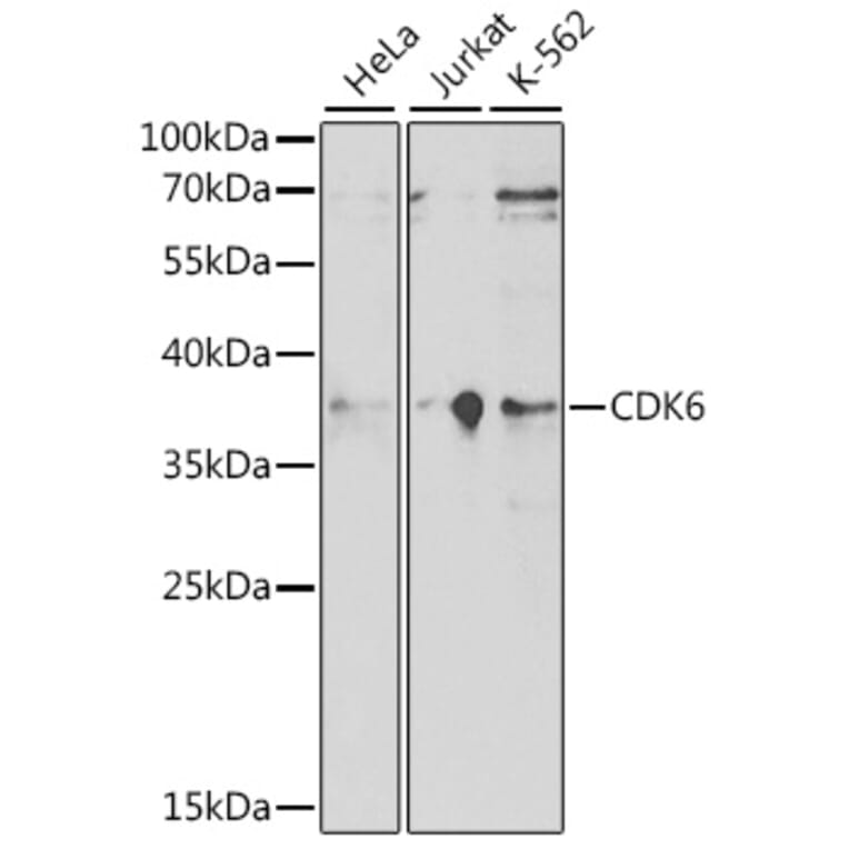 Western Blot - Anti-Cdk6 Antibody (A91841) - Antibodies.com