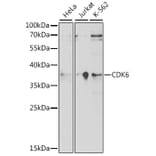 Western Blot - Anti-Cdk6 Antibody (A91841) - Antibodies.com