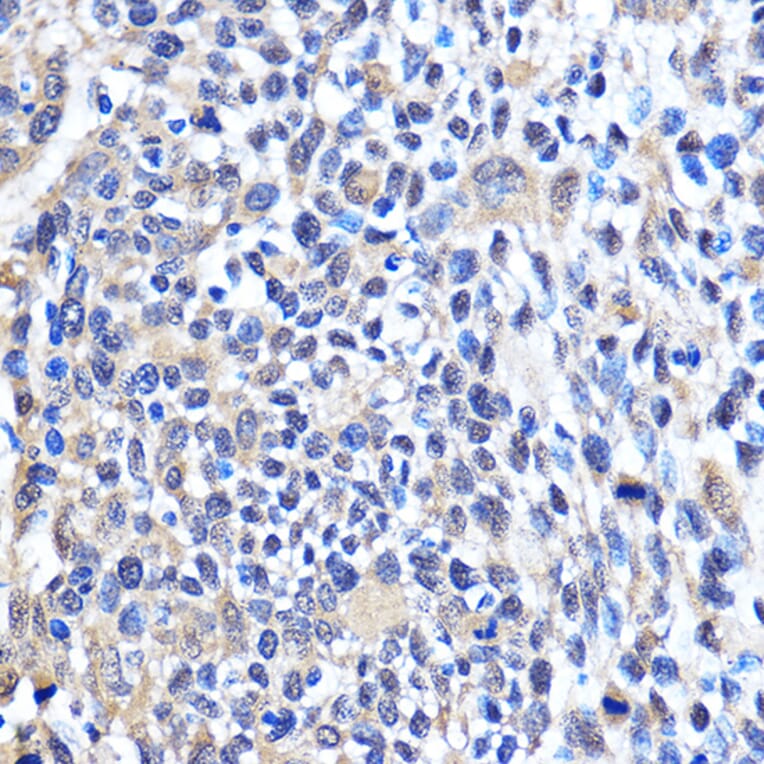 Immunohistochemistry - Anti-Cdk6 Antibody (A91841) - Antibodies.com