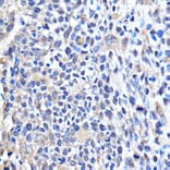 Immunohistochemistry - Anti-Cdk6 Antibody (A91841) - Antibodies.com