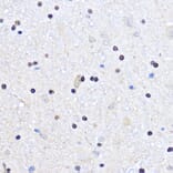 Immunohistochemistry - Anti-Cdk6 Antibody (A91841) - Antibodies.com