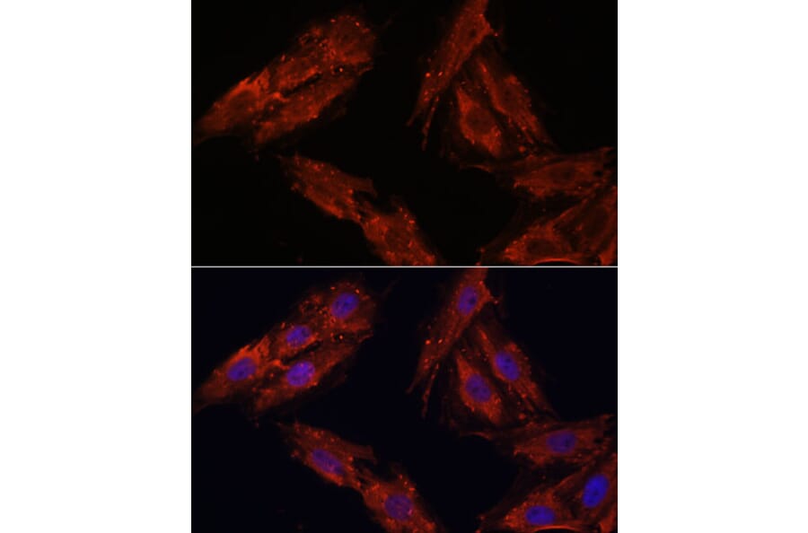 Immunofluorescence - Anti-Cdk6 Antibody (A91841) - Antibodies.com