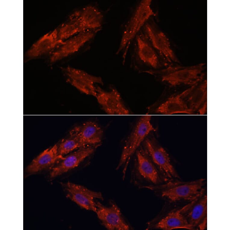 Immunofluorescence - Anti-Cdk6 Antibody (A91841) - Antibodies.com