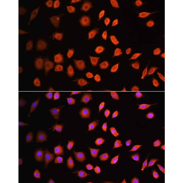 Immunofluorescence - Anti-Cdk6 Antibody (A91841) - Antibodies.com