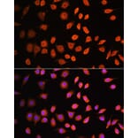 Immunofluorescence - Anti-Cdk6 Antibody (A91841) - Antibodies.com