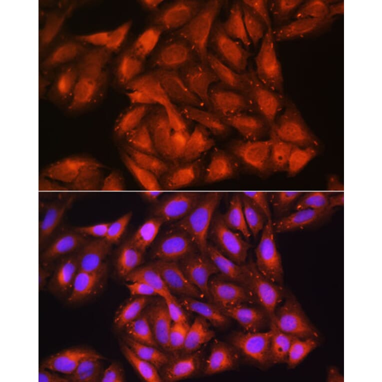 Immunofluorescence - Anti-Cdk6 Antibody (A91841) - Antibodies.com