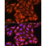 Immunofluorescence - Anti-Cdk6 Antibody (A91841) - Antibodies.com