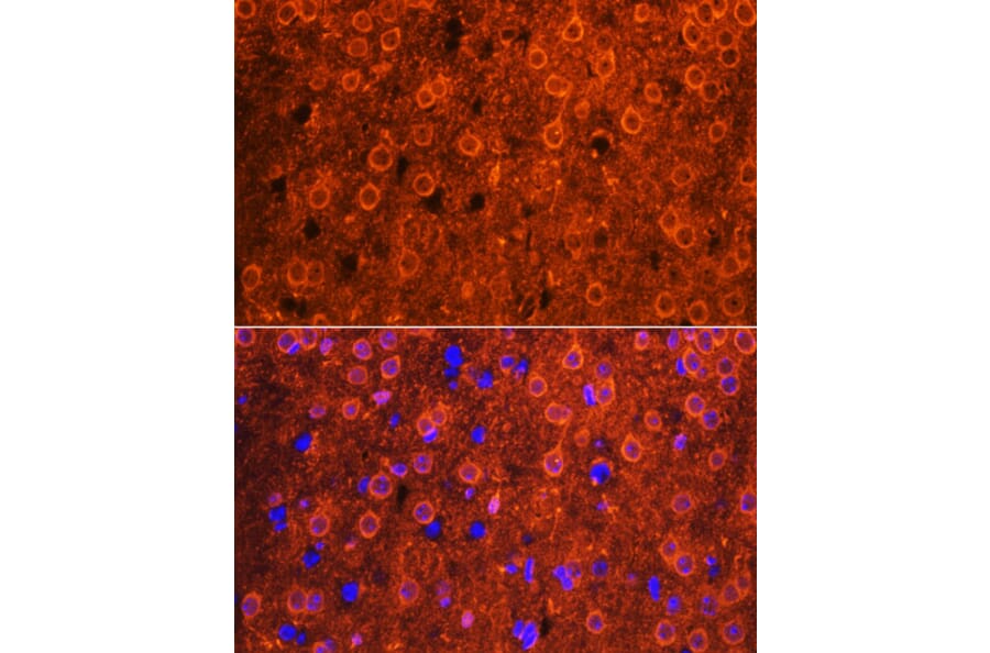Immunofluorescence - Anti-Cdk6 Antibody (A91841) - Antibodies.com