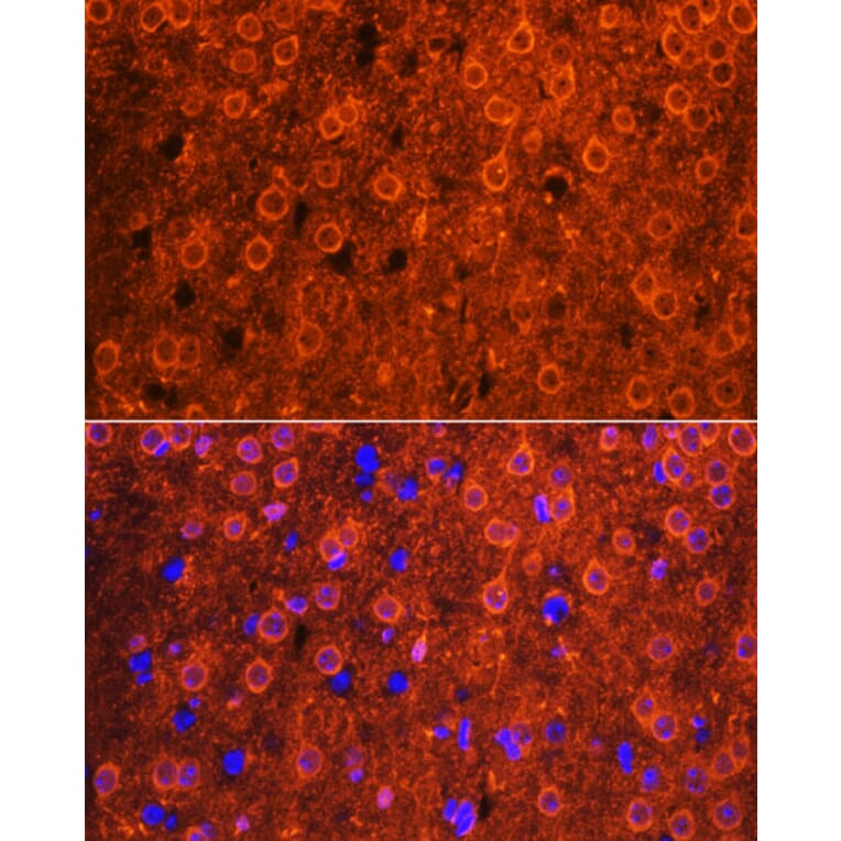 Immunofluorescence - Anti-Cdk6 Antibody (A91841) - Antibodies.com