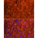 Immunofluorescence - Anti-Cdk6 Antibody (A91841) - Antibodies.com