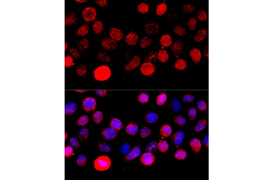 Immunofluorescence - Anti-BAZ1A Antibody (A16495) - Antibodies.com