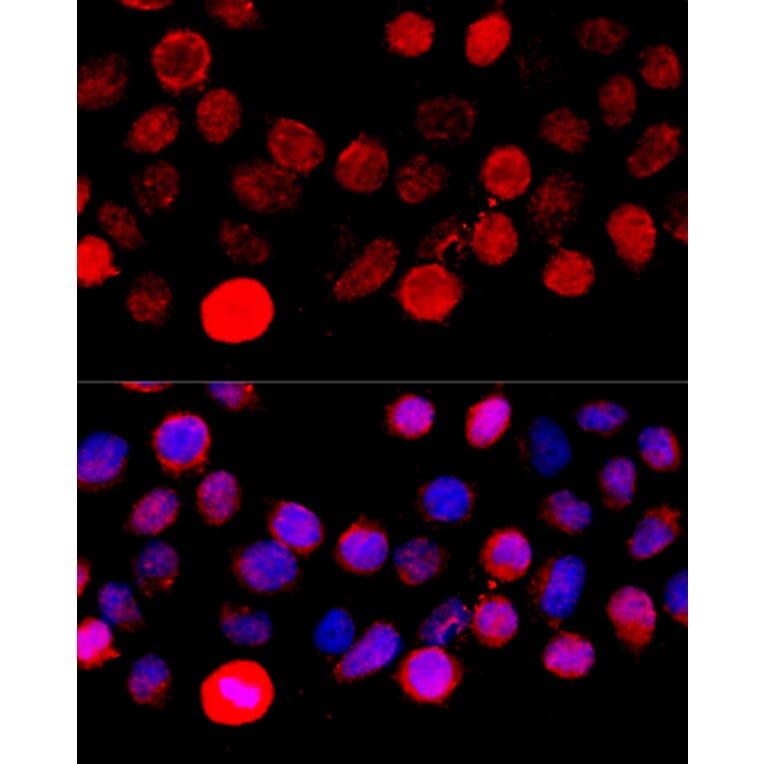 Immunofluorescence - Anti-BAZ1A Antibody (A16495) - Antibodies.com