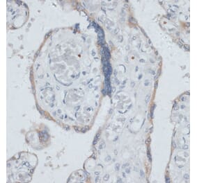 Immunohistochemistry - Anti-Dysbindin Antibody (A91843) - Antibodies.com