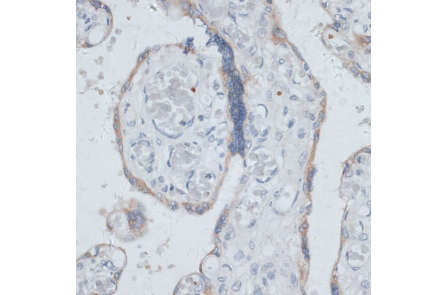 Immunohistochemistry - Anti-Dysbindin Antibody (A91843) - Antibodies.com