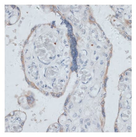 Immunohistochemistry - Anti-Dysbindin Antibody (A91843) - Antibodies.com