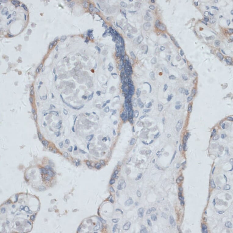 Immunohistochemistry - Anti-Dysbindin Antibody (A91843) - Antibodies.com