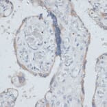 Immunohistochemistry - Anti-Dysbindin Antibody (A91843) - Antibodies.com