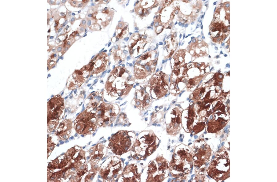 Immunohistochemistry - Anti-Dysbindin Antibody (A91843) - Antibodies.com