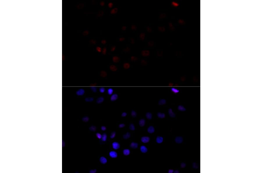 Immunofluorescence - Anti-TBP Antibody (A16436) - Antibodies.com