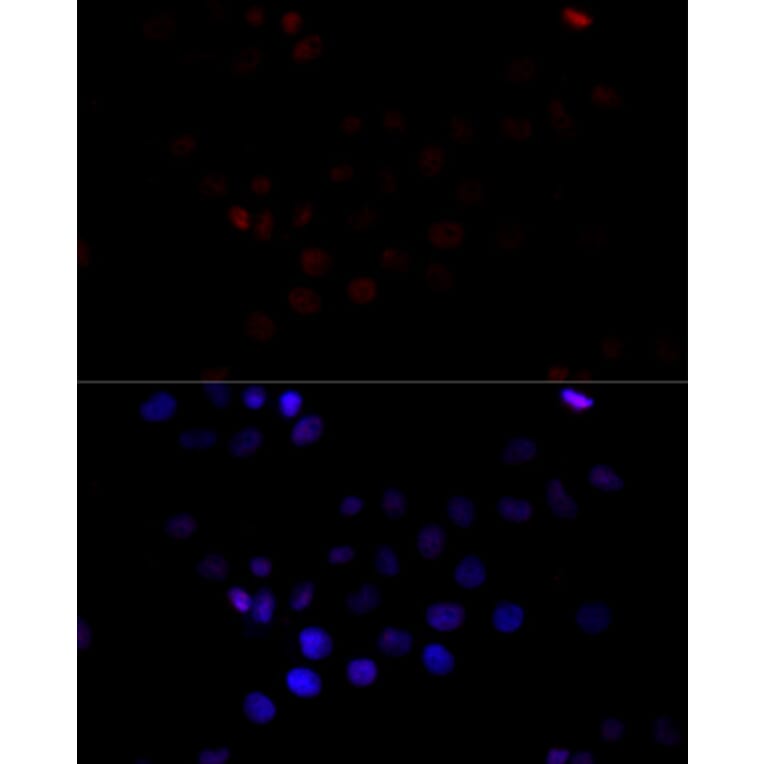 Immunofluorescence - Anti-TBP Antibody (A16436) - Antibodies.com