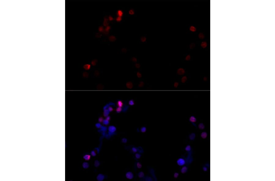 Immunofluorescence - Anti-TBP Antibody (A16436) - Antibodies.com
