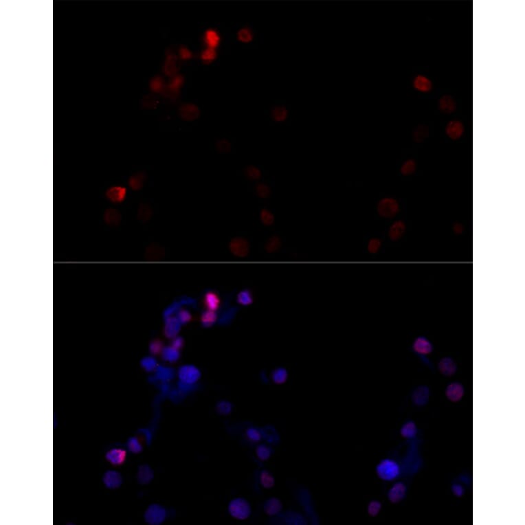 Immunofluorescence - Anti-TBP Antibody (A16436) - Antibodies.com