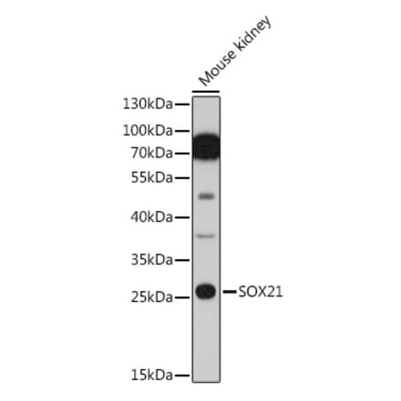 Western Blot - Anti-SOX21 Antibody (A91847) - Antibodies.com