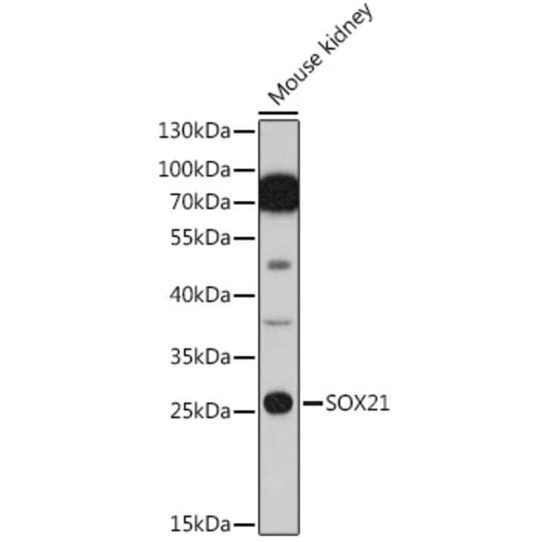 Western Blot - Anti-SOX21 Antibody (A91847) - Antibodies.com