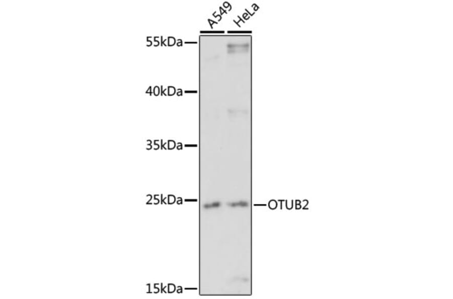 Western Blot - Anti-OTUB2 Antibody (A91848) - Antibodies.com