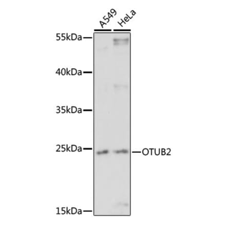 Western Blot - Anti-OTUB2 Antibody (A91848) - Antibodies.com