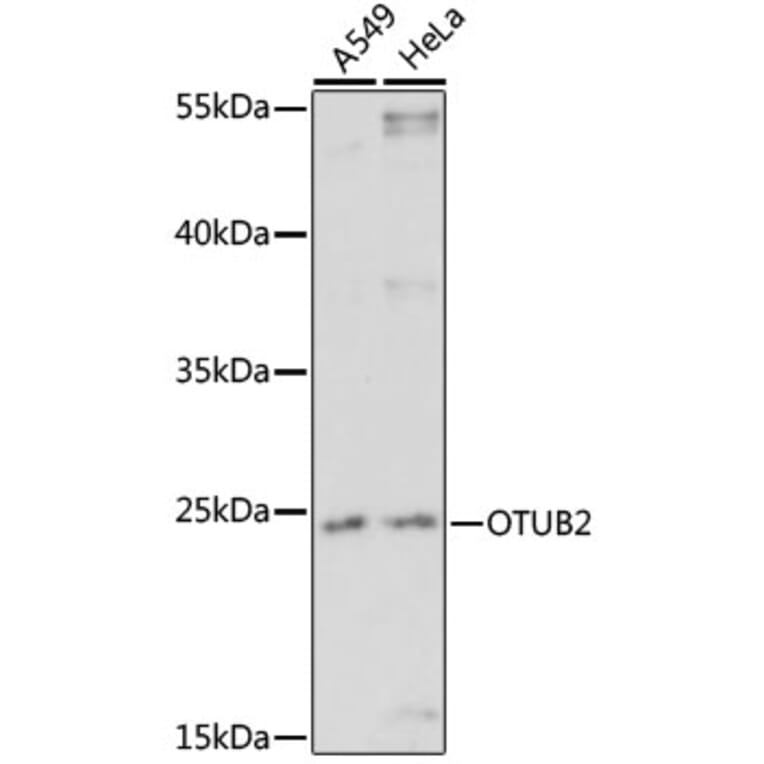 Western Blot - Anti-OTUB2 Antibody (A91848) - Antibodies.com