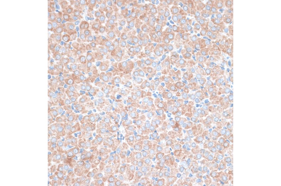 Immunohistochemistry - Anti-TMEPAI Antibody (A91849) - Antibodies.com