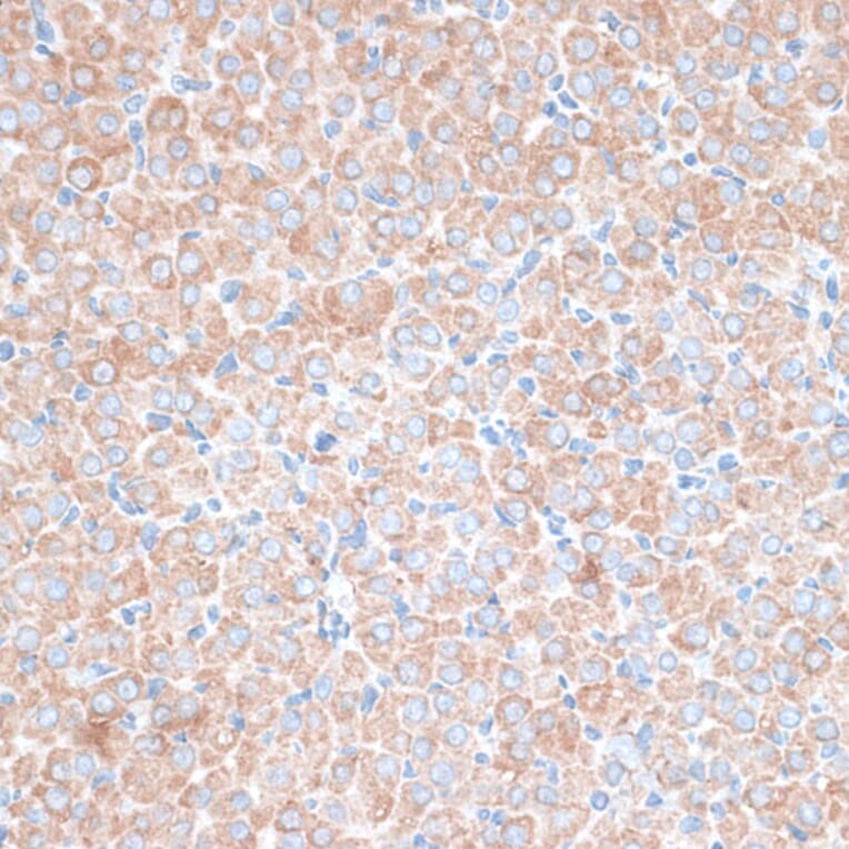 Immunohistochemistry - Anti-TMEPAI Antibody (A91849) - Antibodies.com