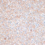 Immunohistochemistry - Anti-TMEPAI Antibody (A91849) - Antibodies.com