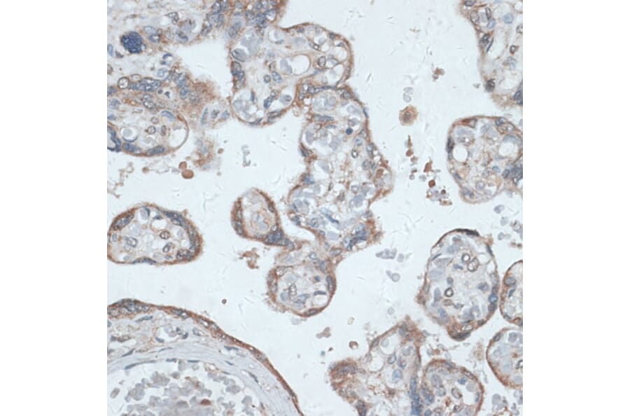 Immunohistochemistry - Anti-TMEPAI Antibody (A91849) - Antibodies.com