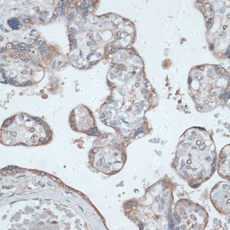 Immunohistochemistry - Anti-TMEPAI Antibody (A91849) - Antibodies.com
