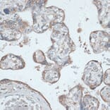Immunohistochemistry - Anti-TMEPAI Antibody (A91849) - Antibodies.com