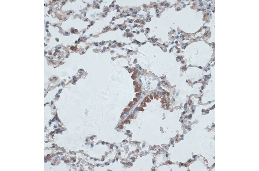 Immunohistochemistry - Anti-TMEPAI Antibody (A91849) - Antibodies.com