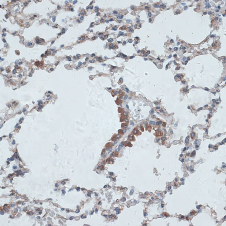 Immunohistochemistry - Anti-TMEPAI Antibody (A91849) - Antibodies.com