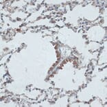 Immunohistochemistry - Anti-TMEPAI Antibody (A91849) - Antibodies.com