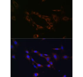 Immunofluorescence - Anti-ABCA1 Antibody (A91853) - Antibodies.com