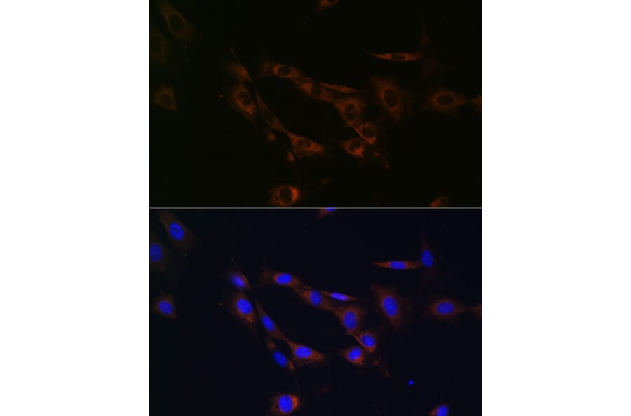 Immunofluorescence - Anti-ABCA1 Antibody (A91853) - Antibodies.com
