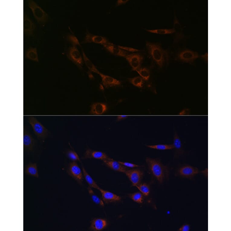 Immunofluorescence - Anti-ABCA1 Antibody (A91853) - Antibodies.com