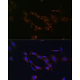 Immunofluorescence - Anti-ABCA1 Antibody (A91853) - Antibodies.com