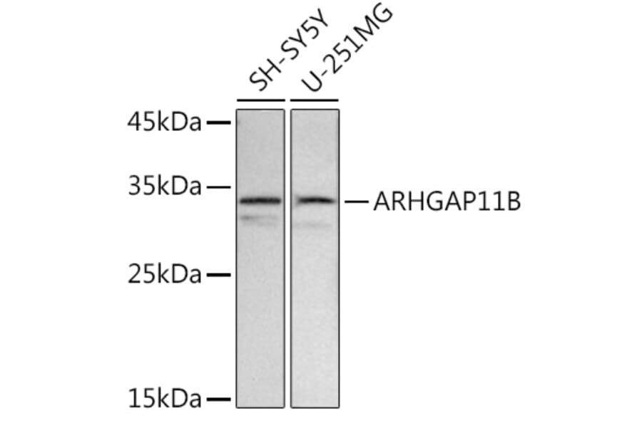 Western Blot - Anti-ARHGAP11B Antibody (A91855) - Antibodies.com