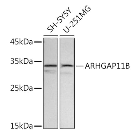 Western Blot - Anti-ARHGAP11B Antibody (A91855) - Antibodies.com