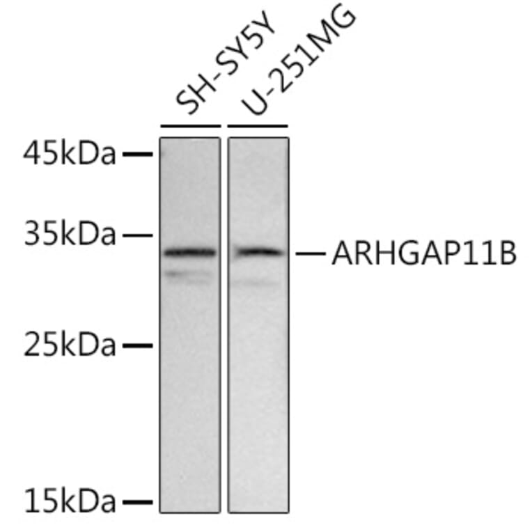 Western Blot - Anti-ARHGAP11B Antibody (A91855) - Antibodies.com